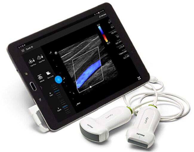 Best Pocket Ultrasound Best Handheld Ultrasound